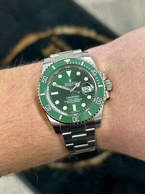 rolex hulk 0 finance